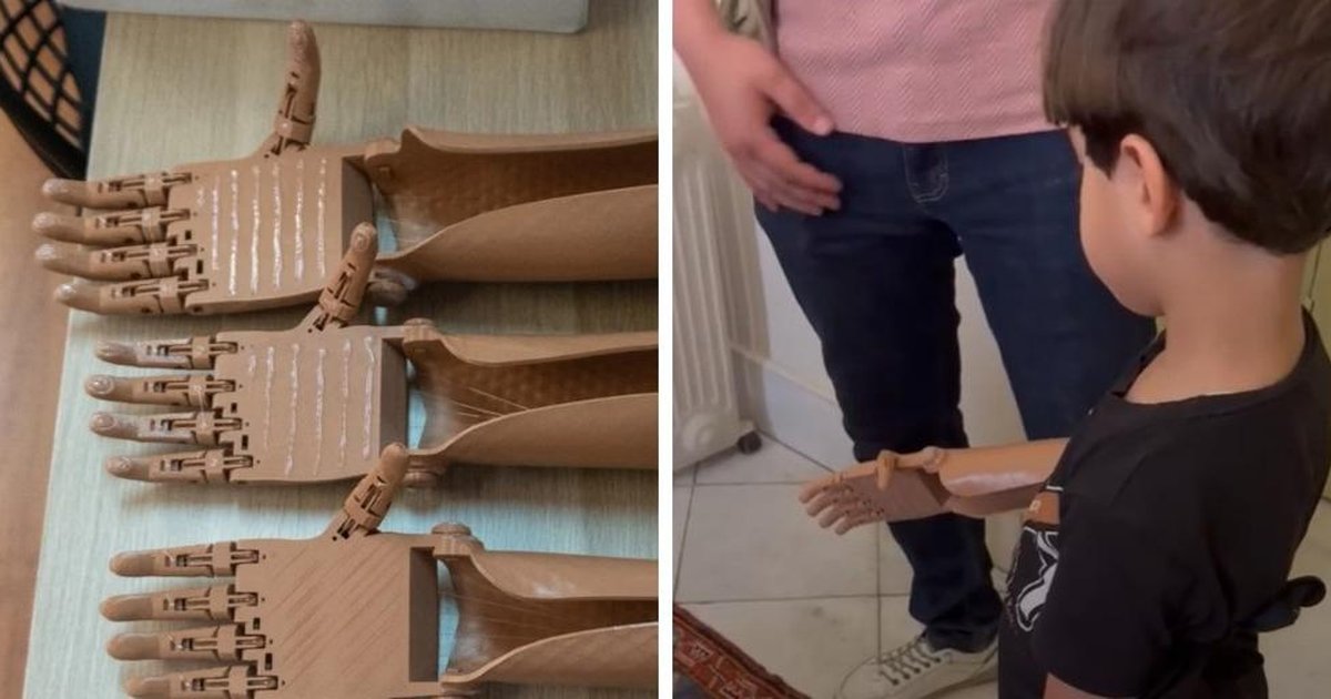La historia del joven español que fabrica y regala prótesis mecánicas impresas en 3D a los niños amputados de Gaza